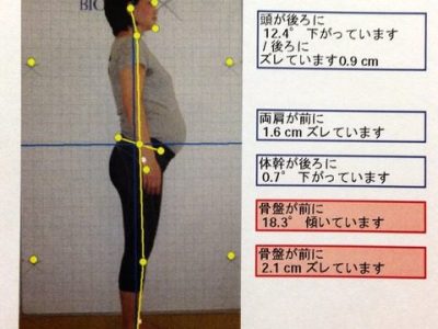 産前・産後のBIOTONIX