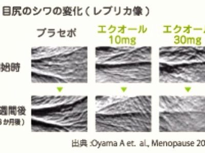 エクオールは深いしわに より効く